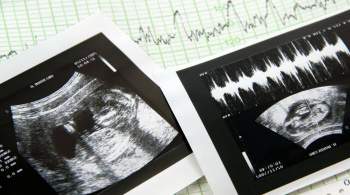 В РПЦ хотят поэтапно вывести аборты из системы ОМС