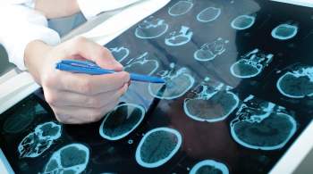 Эксперт назвала COVID-19 пусковым фактором для развития болезни Альцгеймера