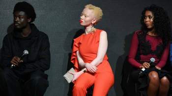 В ООН сообщили о росте убийств людей с альбинизмом из-за пандемии
