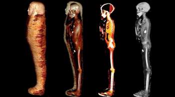 Ученые раскрыли секреты 2300-летней мумии  золотого мальчика 