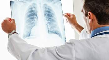 В России заболеваемость туберкулезом за три года снизилась на 24,5 процента
