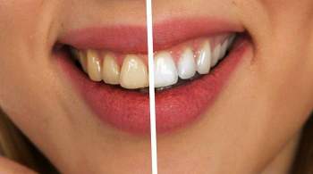 Названы продукты, из-за которых зубы темнеют быстрее всего