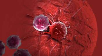 Главный онколог Минздрава назвал вид рака, который не замечают мужчины