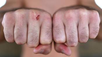 В Адлере сотрудники пляжа жестко избили чемпиона Минска по самбо