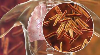В России предложили использовать кумарины против туберкулеза 