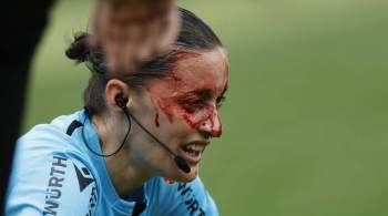 Камера разбила лицо ассистентке арбитра в матче чемпионата Испании 